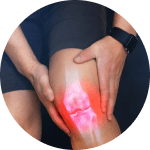 Osteoartrite | Dr. Eduardo Medeiros - Ortopedista
