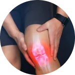Osteoartrite | Dr. Eduardo Medeiros - Ortopedista